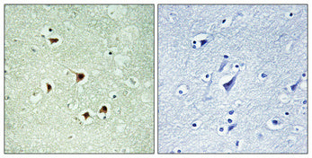Max (phospho Ser2) Rabbit Polyclonal Antibody