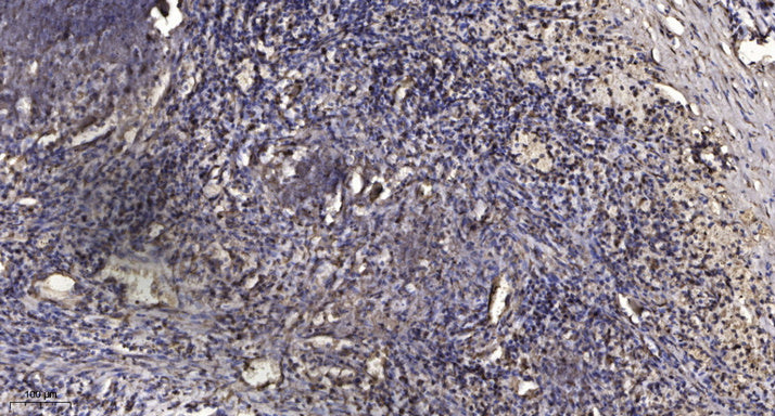 Mcl-1 (phospho-Thr163) Rabbit Polyclonal Antibody