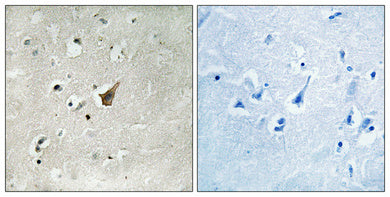 Mucin 1 (phospho Ser1227) Rabbit Polyclonal Antibody