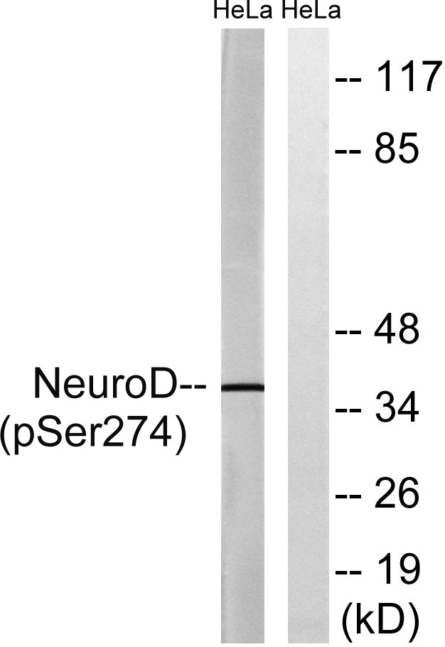 Neuro D (phospho Ser274) Rabbit Polyclonal Antibody