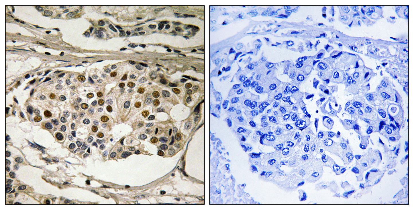 NFκB-p65 (phospho Ser281) Rabbit Polyclonal Antibody