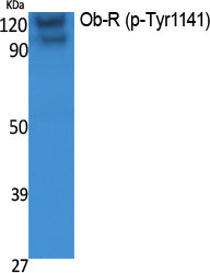 Ob-R (phospho Tyr1141) Rabbit Polyclonal Antibody