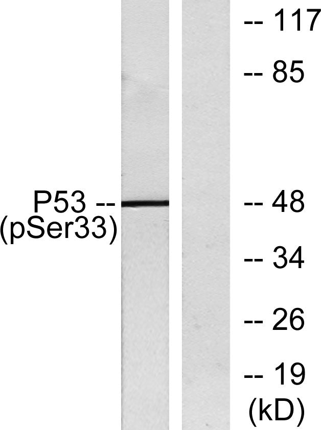 p53 (phospho Ser33) Rabbit Polyclonal Antibody