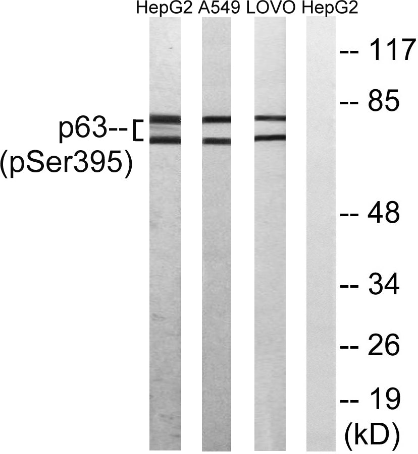 p63 (phospho Ser395) Rabbit Polyclonal Antibody