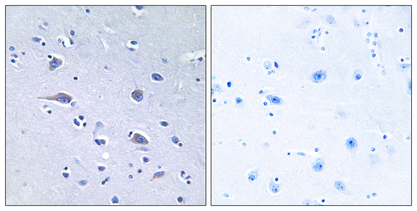 p70 S6 kinase α (phospho Thr229) Rabbit Polyclonal Antibody