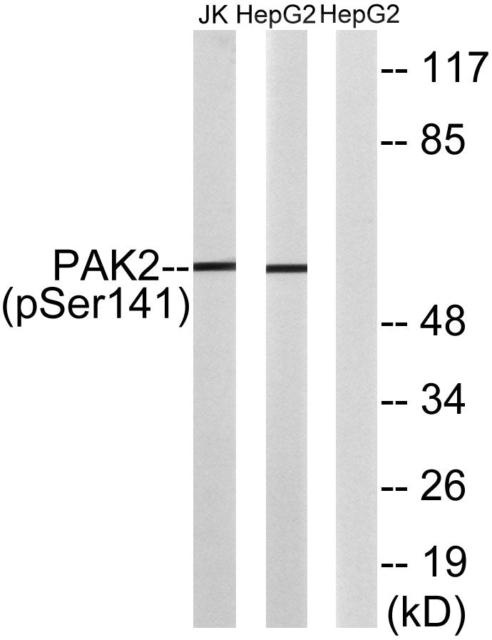 PAKγ (phospho Ser141) Rabbit Polyclonal Antibody