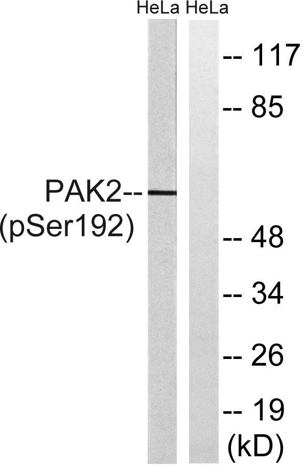 PAKγ (phospho Ser192) Rabbit Polyclonal Antibody