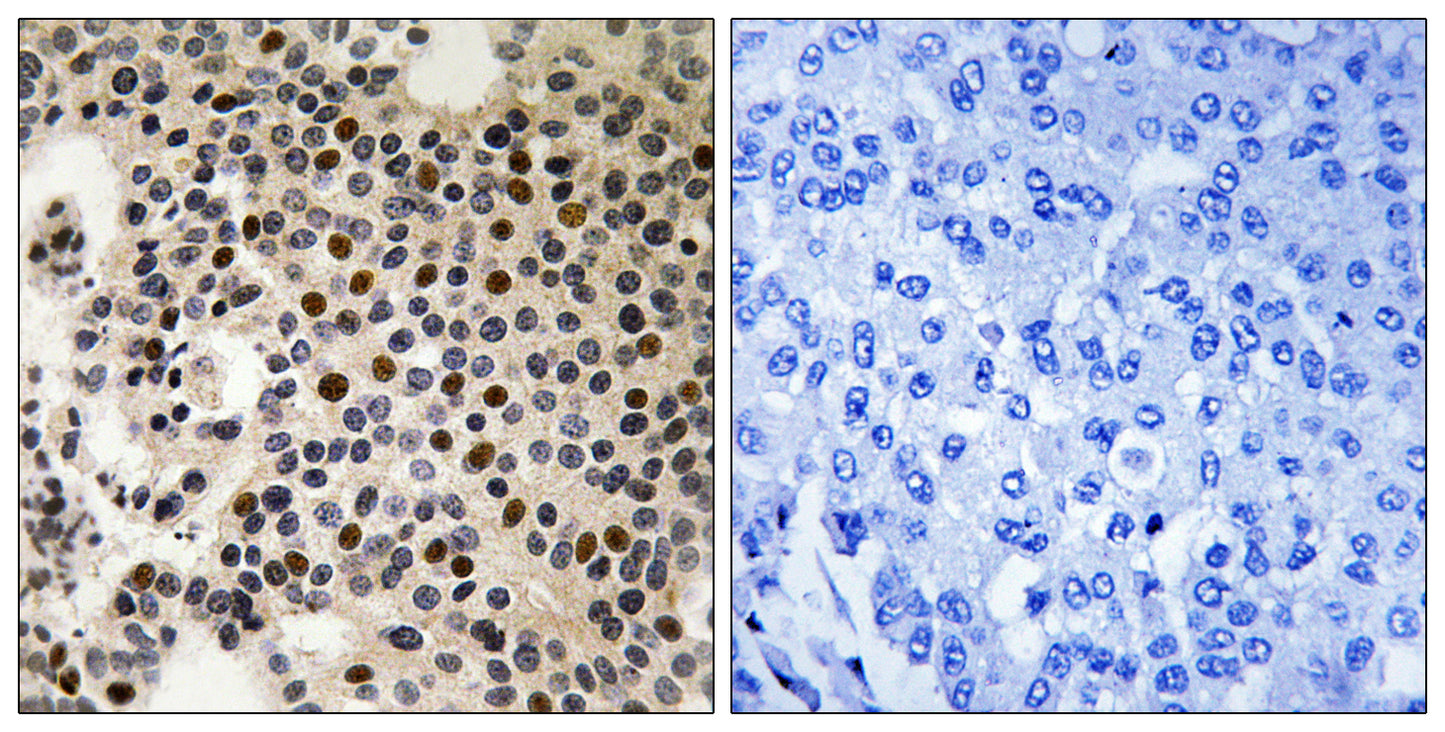 PAKγ (phospho Ser197) Rabbit Polyclonal Antibody