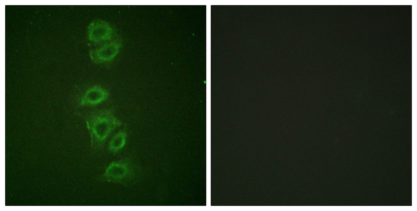 PP2A-Cα (phospho Tyr307) Rabbit Polyclonal Antibody