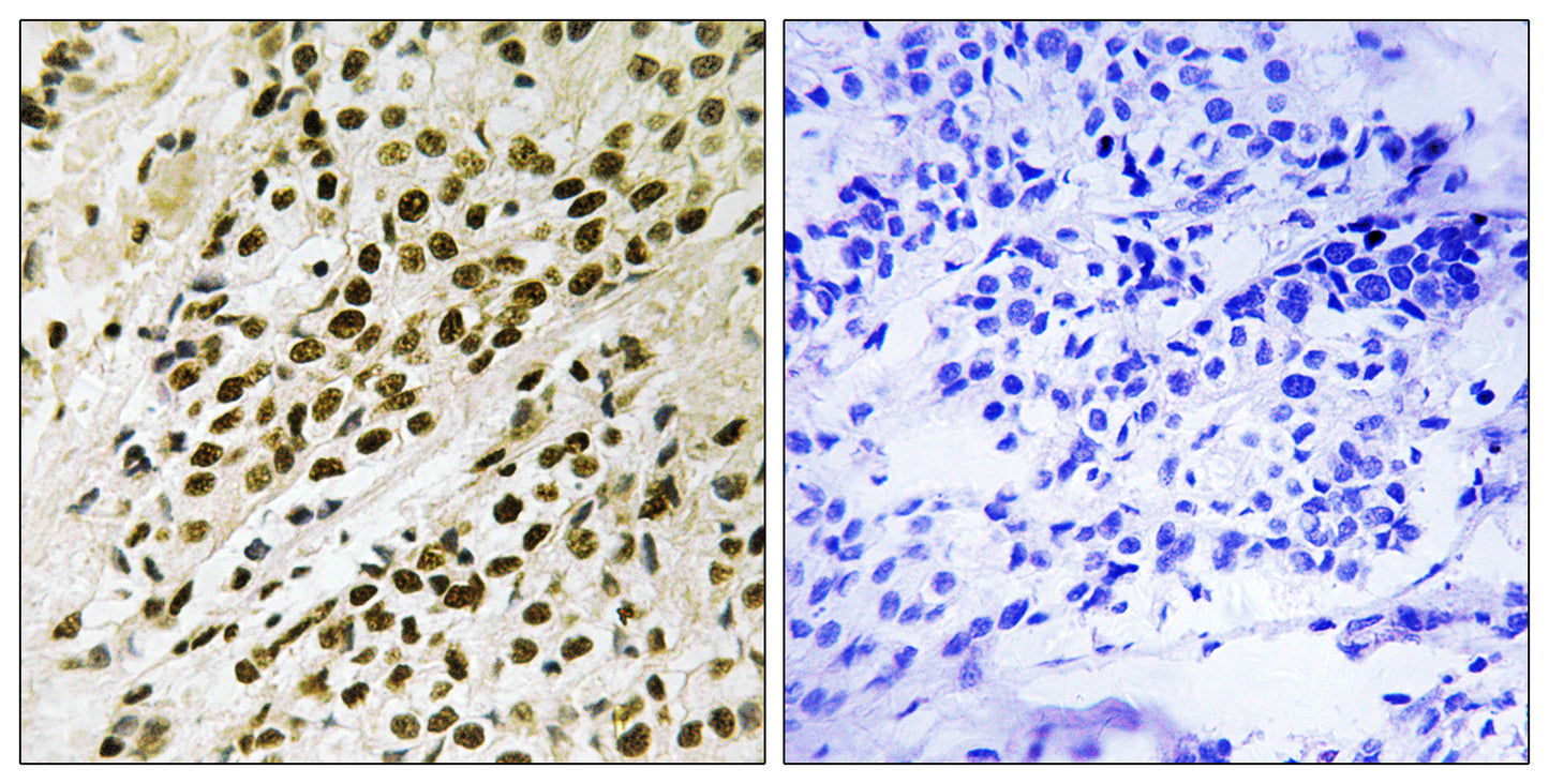PRAK (phospho Thr182) Rabbit Polyclonal Antibody