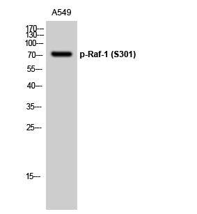 Raf-1 (phospho Ser301) Rabbit Polyclonal Antibody