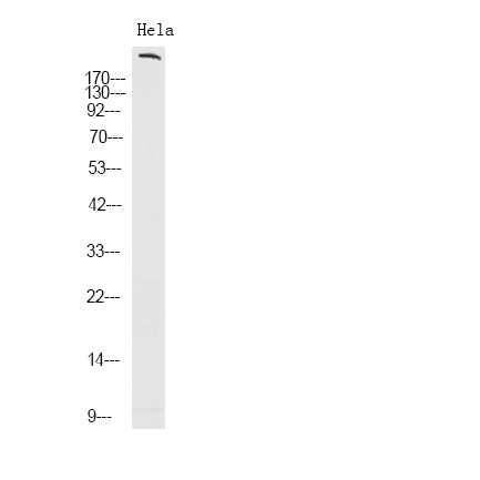 ROS1 (phospho-Tyr2274) Rabbit Polyclonal Antibody