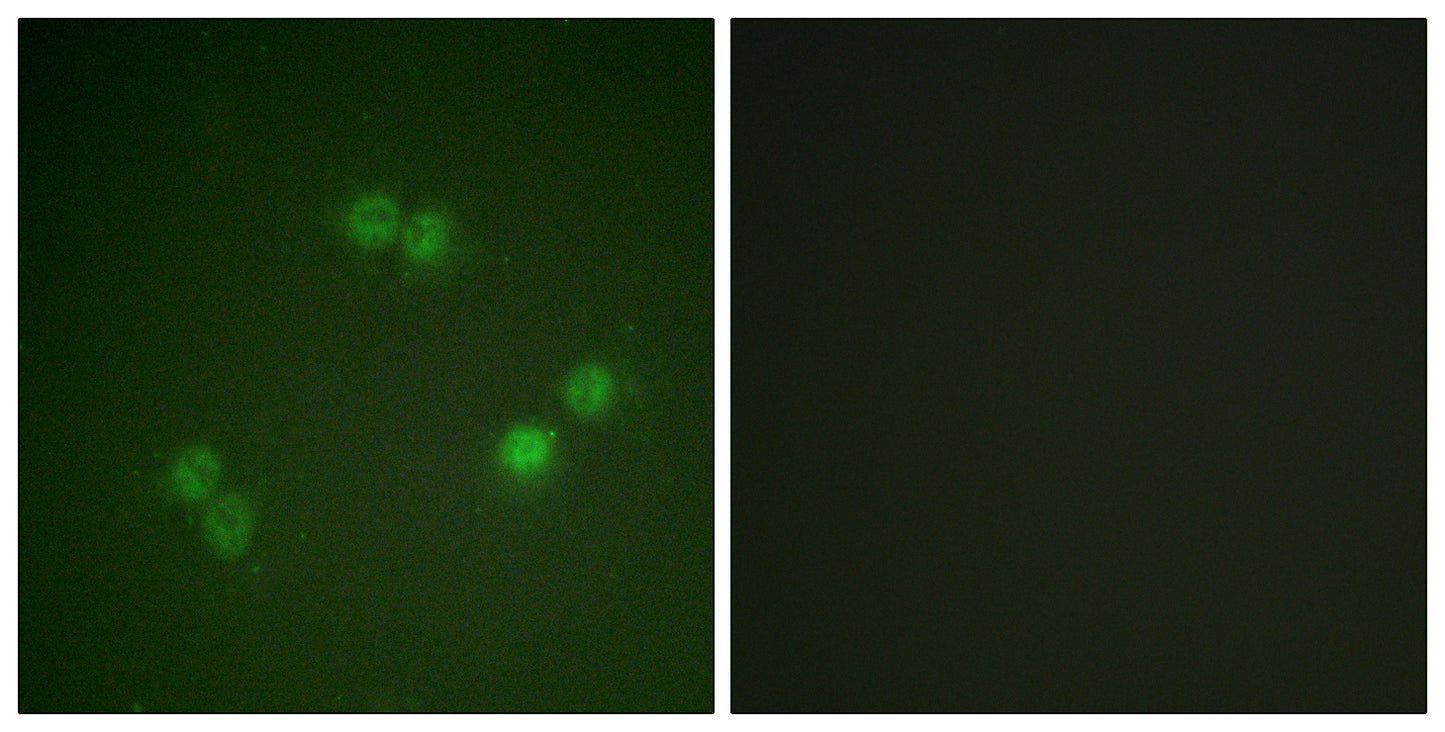 Splicing factor 1 (phospho Ser82) Rabbit Polyclonal Antibody
