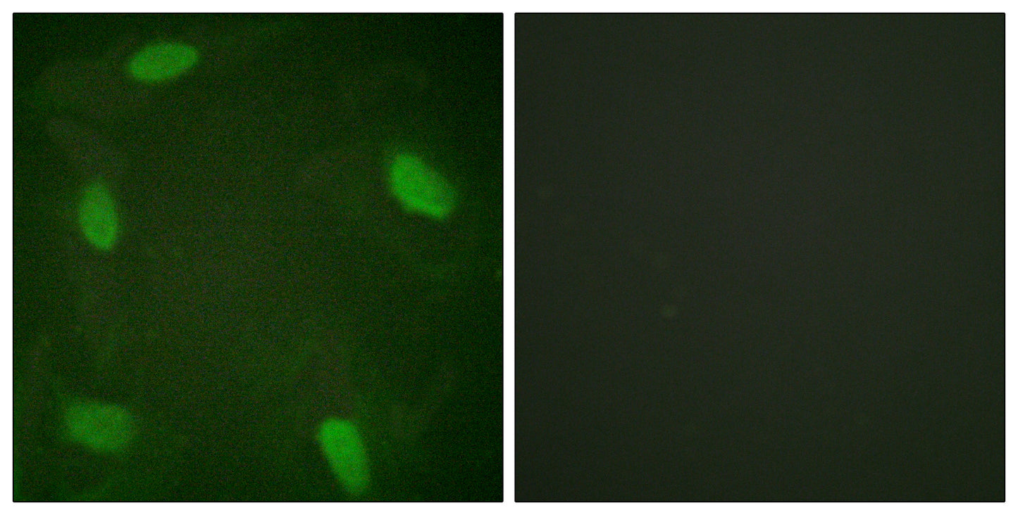 SSB (phospho Ser366) Rabbit Polyclonal Antibody