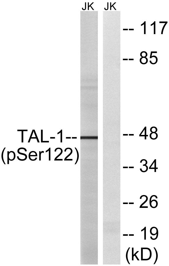 TAL1 (phospho Ser122) Rabbit Polyclonal Antibody