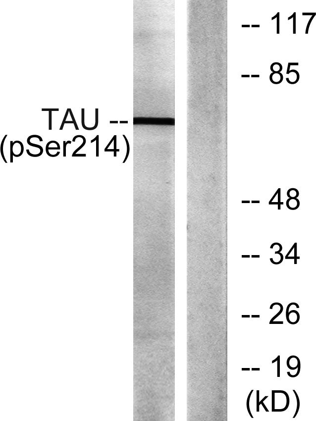 Tau (phospho Ser214) Rabbit Polyclonal Antibody