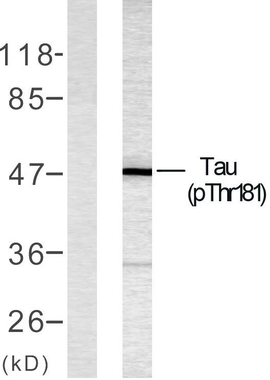 Tau (phospho Thr181) Rabbit Polyclonal Antibody