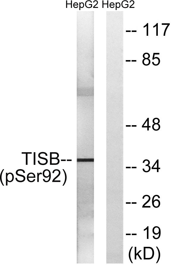 TIS11B (phospho Ser92) Rabbit Polyclonal Antibody