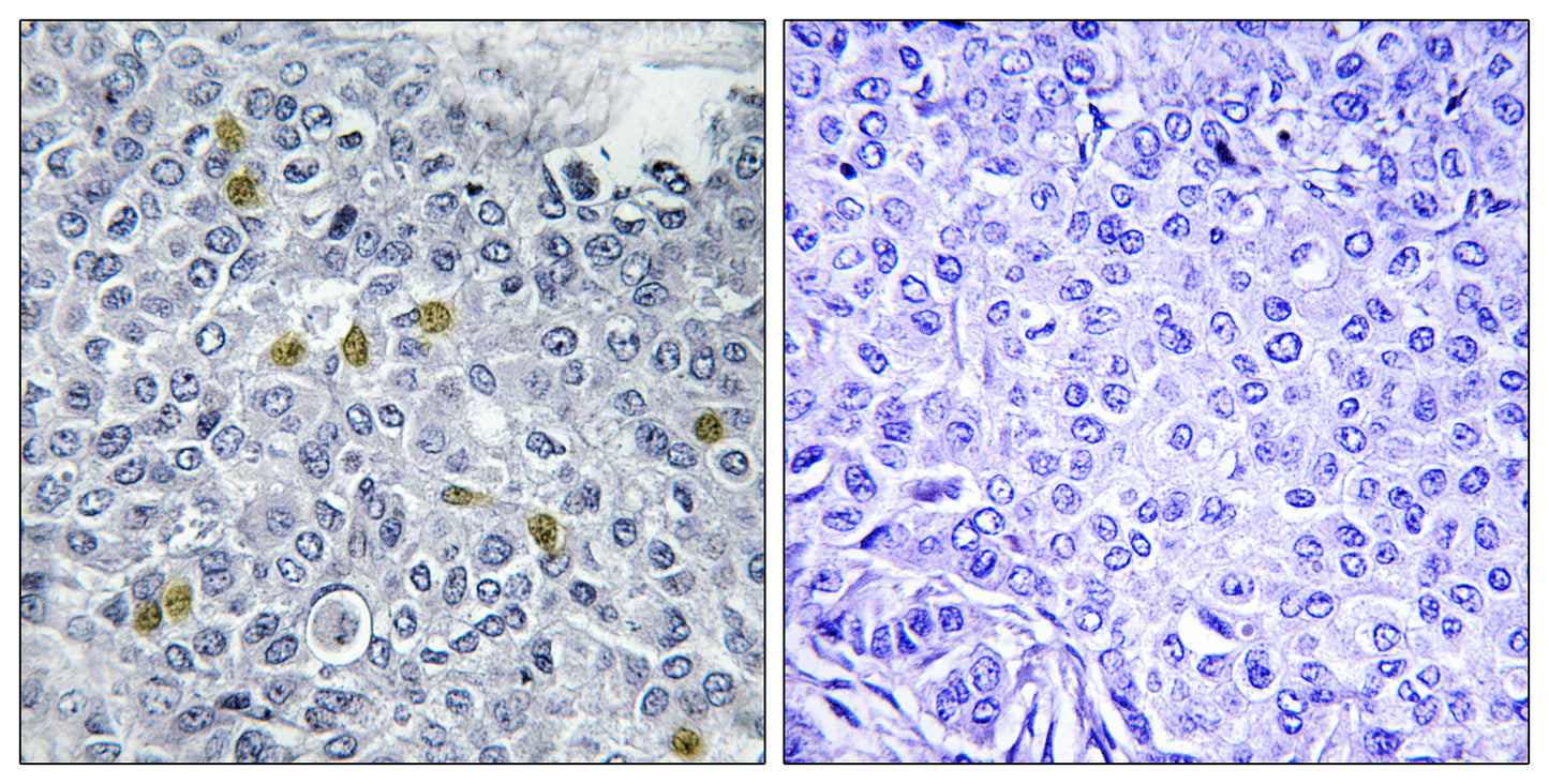 Topo IIα (phospho Ser1106) Rabbit Polyclonal Antibody