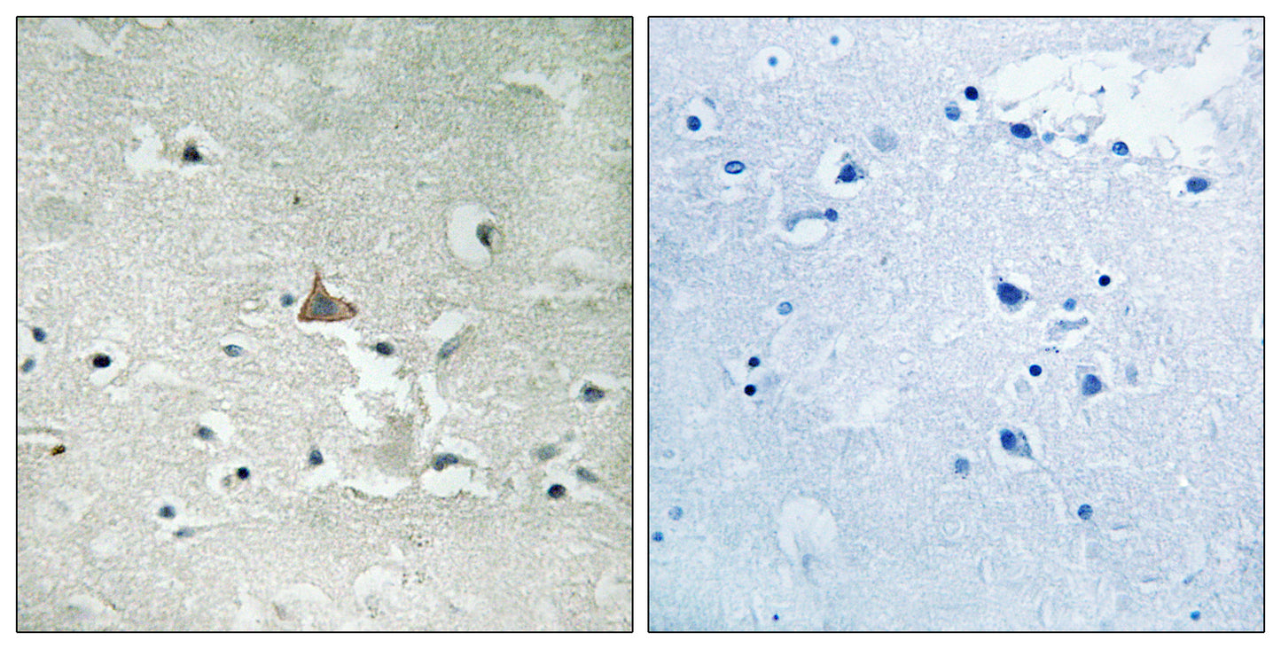 Trk B (phospho Tyr706/Y707) Rabbit Polyclonal Antibody