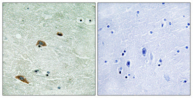 TTK (phospho Thr676) Rabbit Polyclonal Antibody