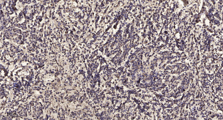VASP (phospho Thr278) Rabbit Polyclonal Antibody