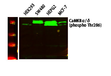 CaMK2 (Phospho-Thr286) Rabbit Polyclonal Antibody