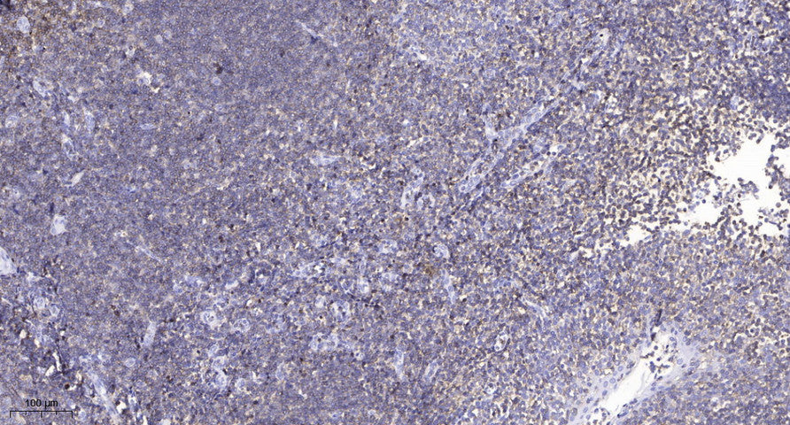 CFTR (Phospho-Ser737) Rabbit Polyclonal Antibody