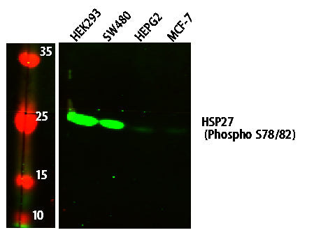 HSP27 (Phospho S78/82) Rabbit Polyclonal Antibody