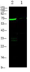L-plastin (Phospho-Ser5) Rabbit Polyclonal Antibody
