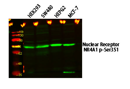 Nuclear Receptor NR4A1 (Phospho-Ser351) Rabbit Polyclonal Antibody