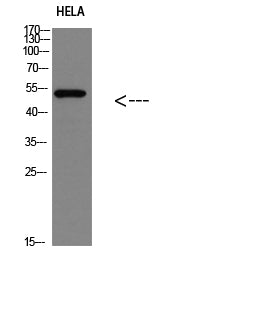 p53(Phospho-Ser366) Rabbit Polyclonal Antibody