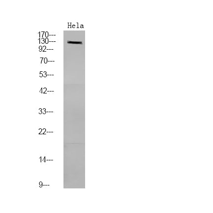 PDE3A (Phospho-Ser312) Rabbit Polyclonal Antibody