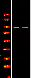 QIK/QSK (Phospho-Thr175/163) Rabbit Polyclonal Antibody