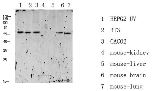 RIPK2 (Phospho-Ser176) Rabbit Polyclonal Antibody