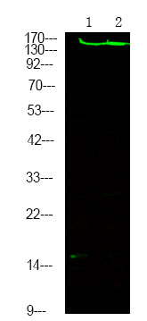 ROCK2 (Phospho-Tyr722) Rabbit Polyclonal Antibody