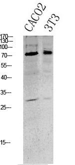 Tau (Phospho-Ser396) Rabbit Polyclonal Antibody