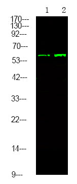 TGFBR2 (Phospho-Tyr284) Rabbit Polyclonal Antibody