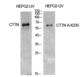 Cortactin (Acetyl Lys235) Rabbit Polyclonal Antibody