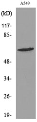 Cytokeratin 8 (Acetyl Lys483) Rabbit Polyclonal Antibody