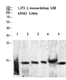 Histone H2B (Acetyl-Lys24/25) Rabbit Polyclonal Antibody