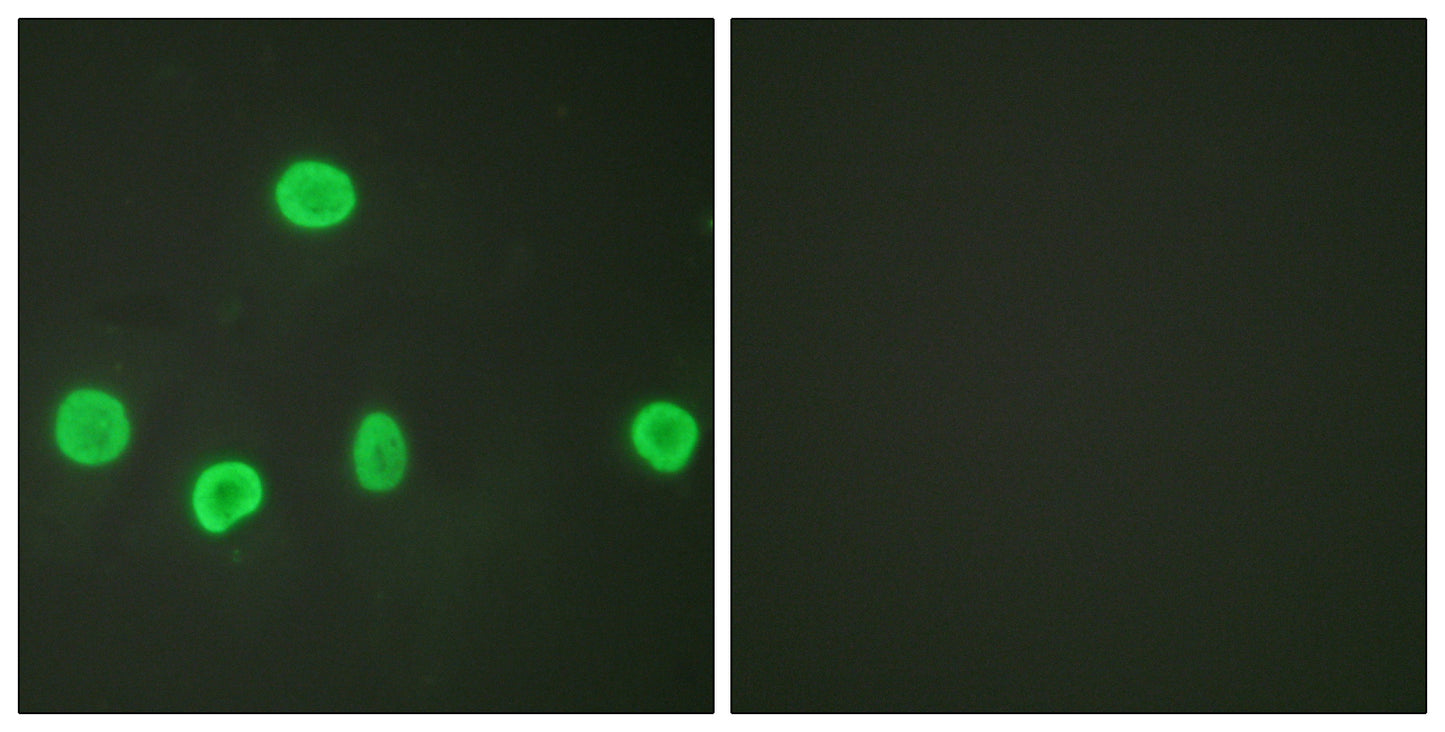 Histone H3 (Acetyl Lys18) Rabbit Polyclonal Antibody