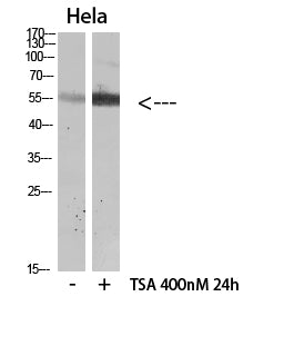 HNF-4α (Acetyl Lys106) Rabbit Polyclonal Antibody