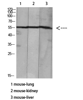 HNF-4α/γ (Acetyl Lys127/79) Rabbit Polyclonal Antibody