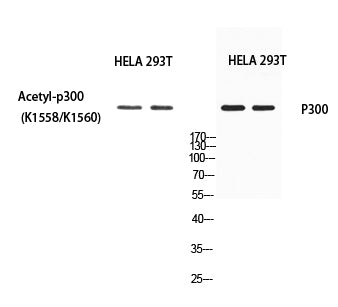 p300 (Acetyl Lys1558/Acetyl Lys1560) Rabbit Polyclonal Antibody