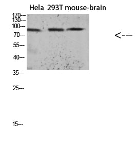 Tau (Acetyl Lys174) Rabbit Polyclonal Antibody