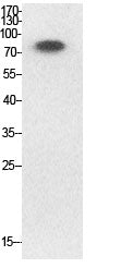 Ub (Acetyl Lys33) Rabbit Polyclonal Antibody