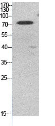 Ub (Acetyl Lys48) Rabbit Polyclonal Antibody