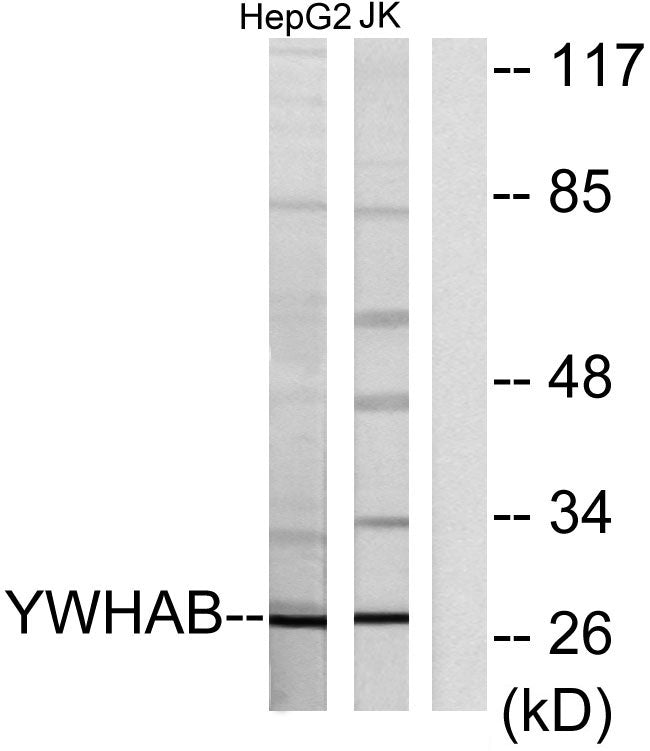 14-3-3 β Rabbit Polyclonal Antibody