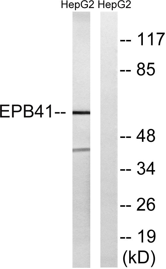4.1R Rabbit Polyclonal Antibody